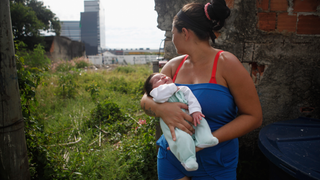 CDC Confirms Zika Causes Microcephaly